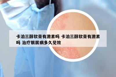 卡泊三醇軟膏有激素嗎 卡泊三醇軟膏有激素嗎 治療銀屑病多久見效