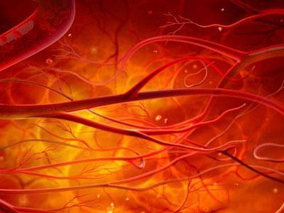 銀屑病藥物還可以減少主動脈炎